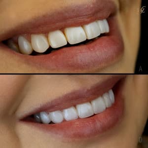 Oral Sin Implantes - Moema em null